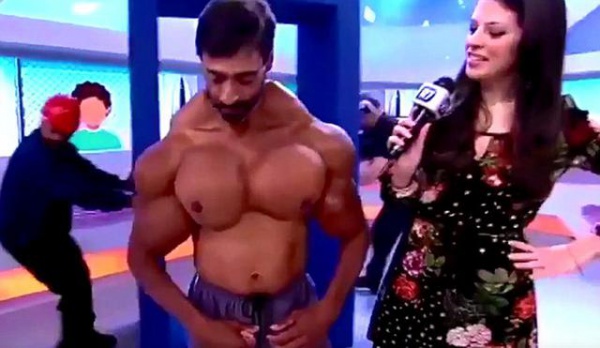 葡萄牙男子注射药物塑造健美肌肉 上电视秀身材反遭批(组图)